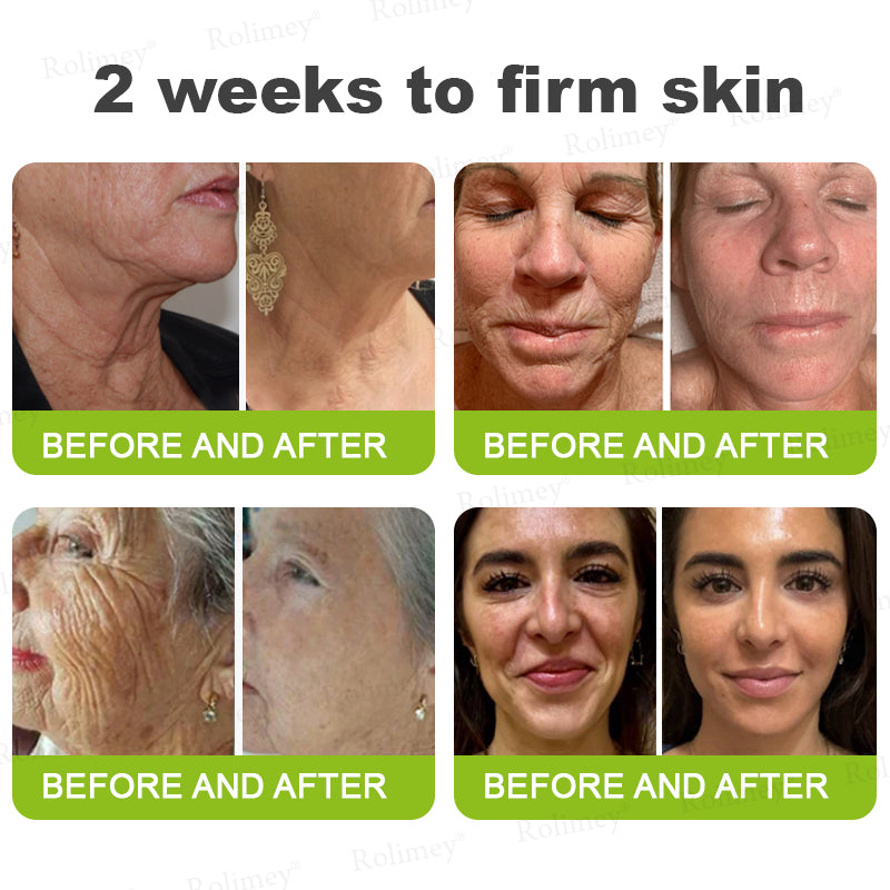 👨‍⚕️🍃🧶Rolimey® Wrinkle-Lift Tightening stick