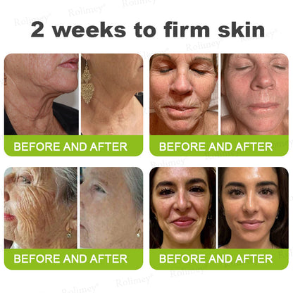 👨‍⚕️🍃Rolimey® Wrinkle-Lift Tightening stick