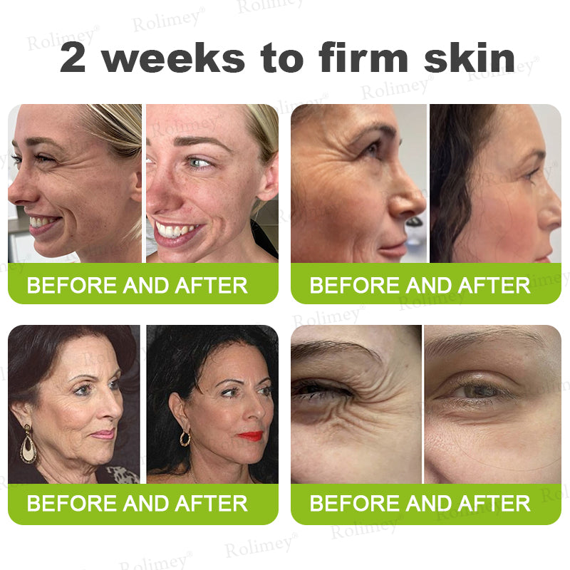 👨‍⚕️🍃Rolimey® Wrinkle-Lift Tightening stick