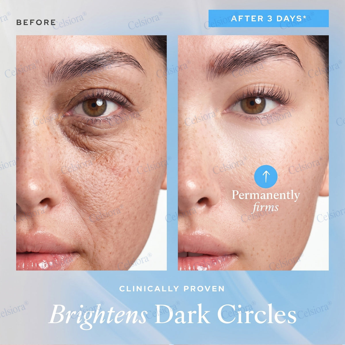 🌐🥈Celsiora® PDRN Anti-Wrinkle Shot – Lift & Firming Cream