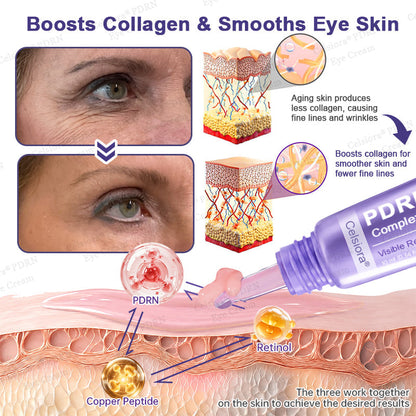 🏅✨Celsiora® PDRN Renewal Complex Eye Cream | Wrinkles, Puffiness & Dark Circles