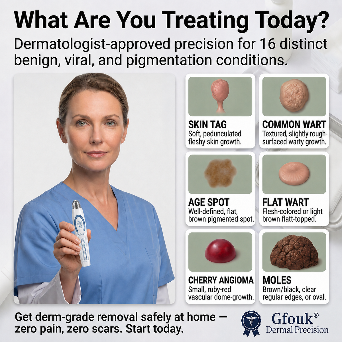 𝐎𝐟𝐟𝐢𝐜𝐢𝐚𝐥 𝐁𝐫𝐚𝐧𝐝 𝐒𝐭𝐨𝐫𝐞 |✒️GFOUK® Fast-Acting Wart Remover Care Pen | Targets Warts, Skin Tags & Rough Bumps(Zero Pain, Zero 𝐒𝐜𝐚𝒓𝒔 Rollerball)