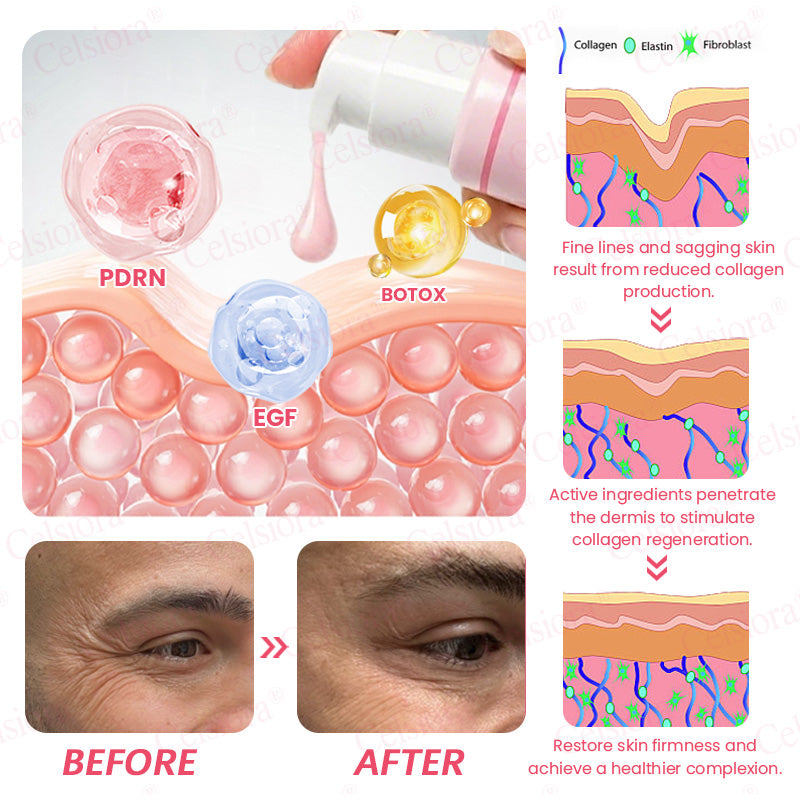 🍃Celsiora® PDRN Pink Peptide Eye Cream