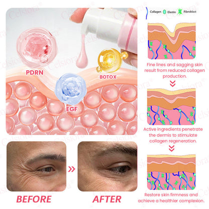 🍃Celsiora® PDRN Pink Peptide Eye Cream