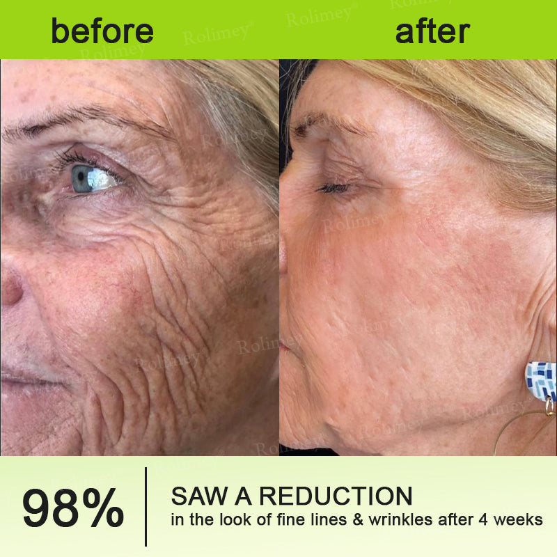 🍀Rolimey® Wrinkle-Lift Tightening cream