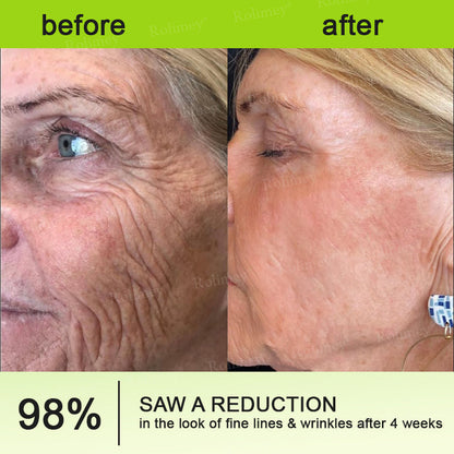 🍀Rolimey® Wrinkle-Lift Tightening cream
