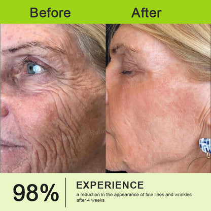 👨‍⚕️🍃🧶Rolimey® Wrinkle-Lift Tightening stick