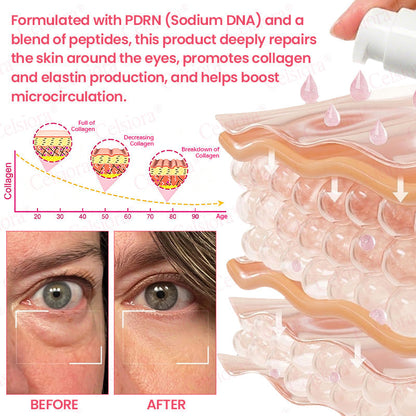 🍃Celsiora® PDRN Pink Peptide Eye Cream (UPSELL)