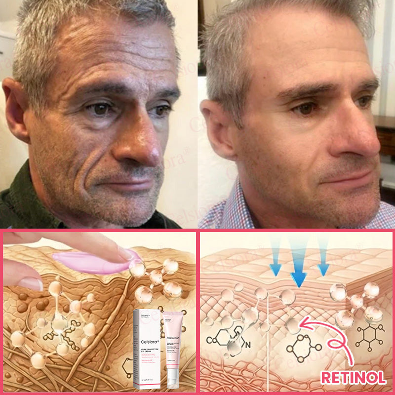 🍃Celsiora® PDRN Pink Peptide Eye Cream