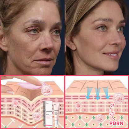 🍃Celsiora® PDRN Pink Peptide Eye Cream (UPSELL)