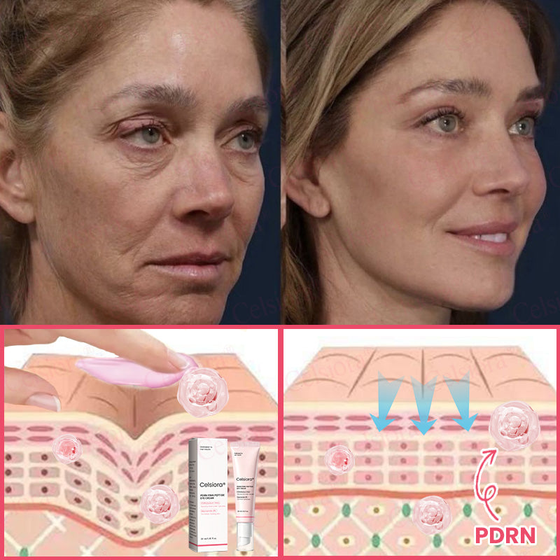🍃Celsiora® PDRN Pink Peptide Eye Cream