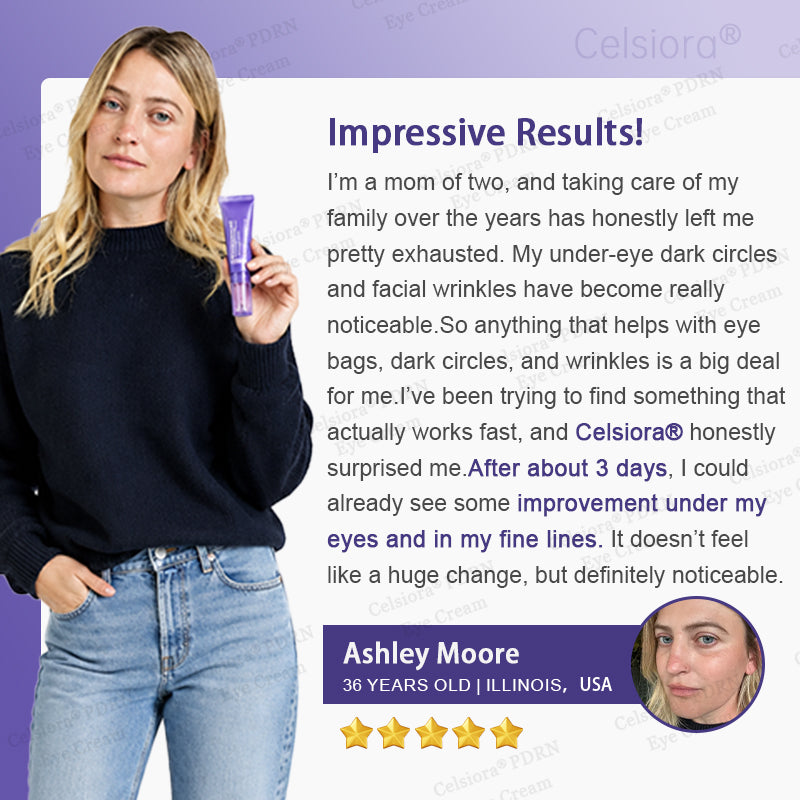 ✨Celsiora® PDRN Renewal Complex Eye Cream (upsell)