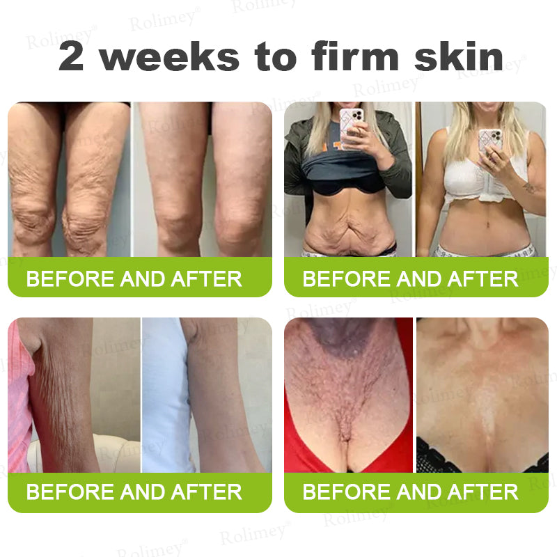 👨‍⚕️🍃🍃Rolimey® Wrinkle-Lift Tightening stick