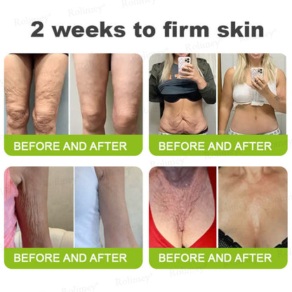 👨‍⚕️🍃🍃Rolimey® Wrinkle-Lift Tightening stick