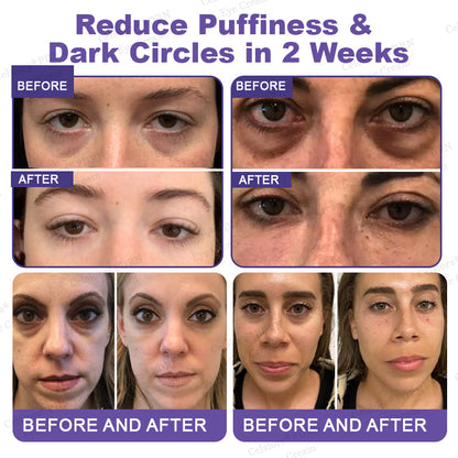 🏅✨Celsiora® PDRN Renewal Complex Eye Cream | Wrinkles, Puffiness & Dark Circles