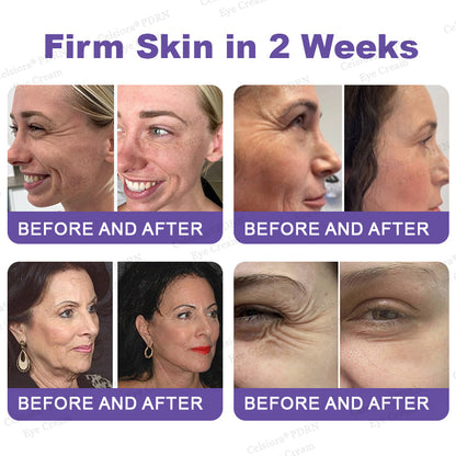 🏅✨Celsiora® PDRN Renewal Complex Eye Cream | Wrinkles, Puffiness & Dark Circles