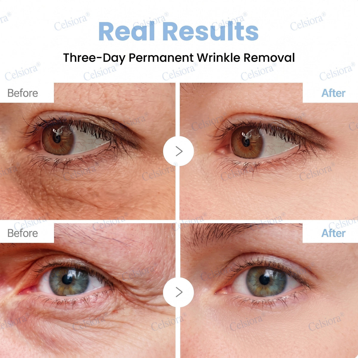 🌐🥈Celsiora® PDRN Anti-Wrinkle Shot – Lift & Firming Cream
