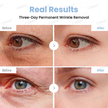 🌐🥈Celsiora® PDRN Anti-Wrinkle Shot – Lift & Firming Cream