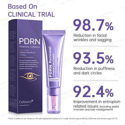 ✨Celsiora® PDRN Renewal Complex Eye Cream (upsell)