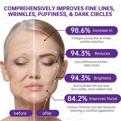 🏅✨Celsiora® PDRN Renewal Complex Eye Cream | Wrinkles, Puffiness & Dark Circles