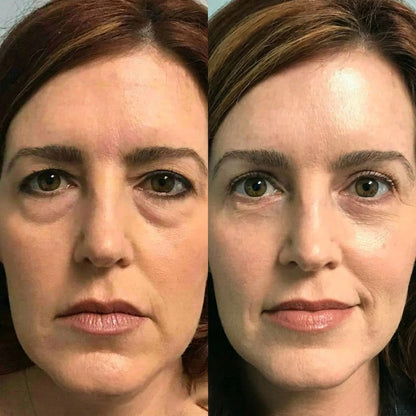 🍀Rolimey® Wrinkle-Lift Tightening cream