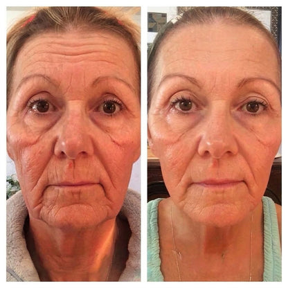 🍀Rolimey® Wrinkle-Lift Tightening cream
