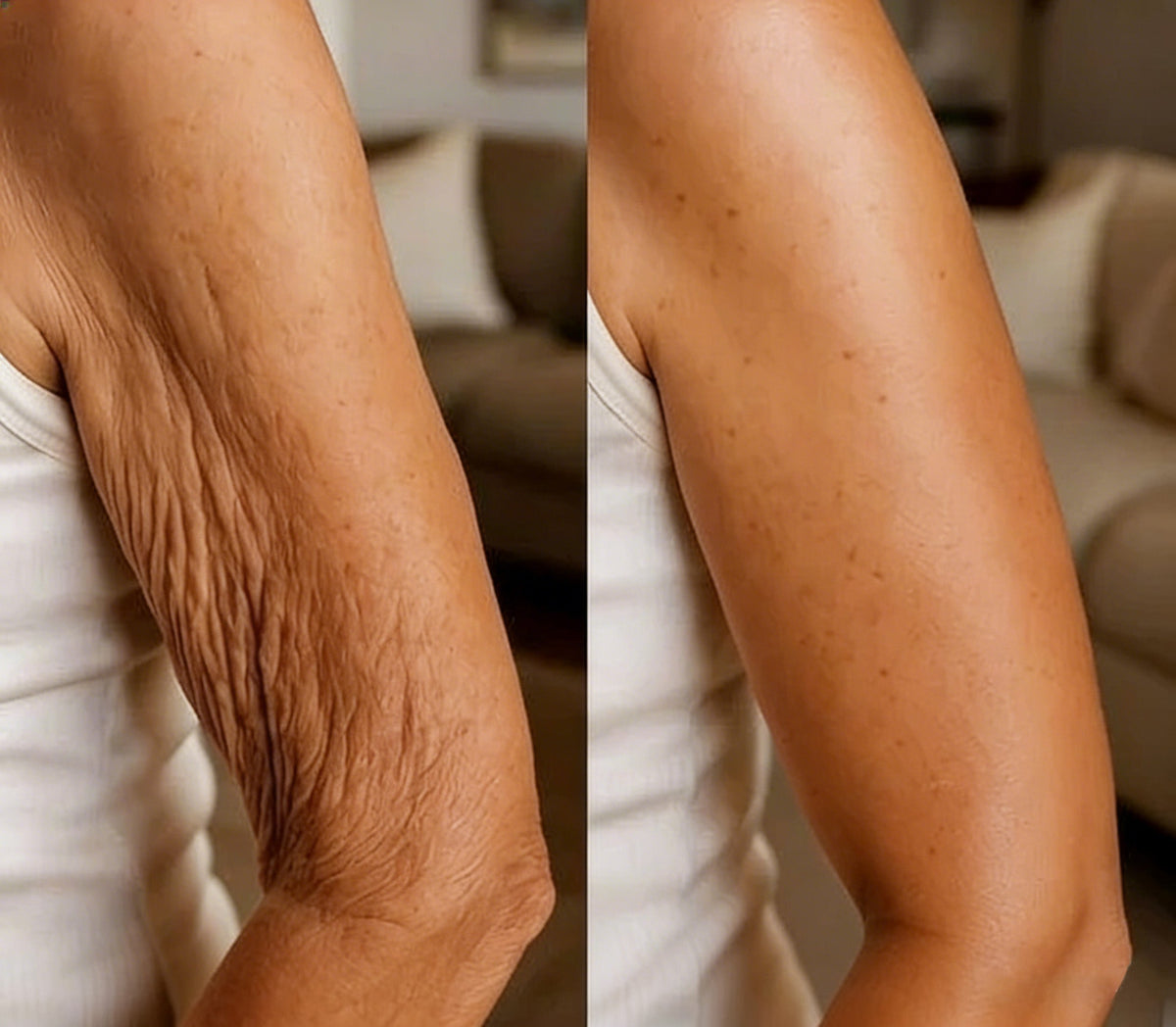 🍀Rolimey® Wrinkle-Lift Tightening cream