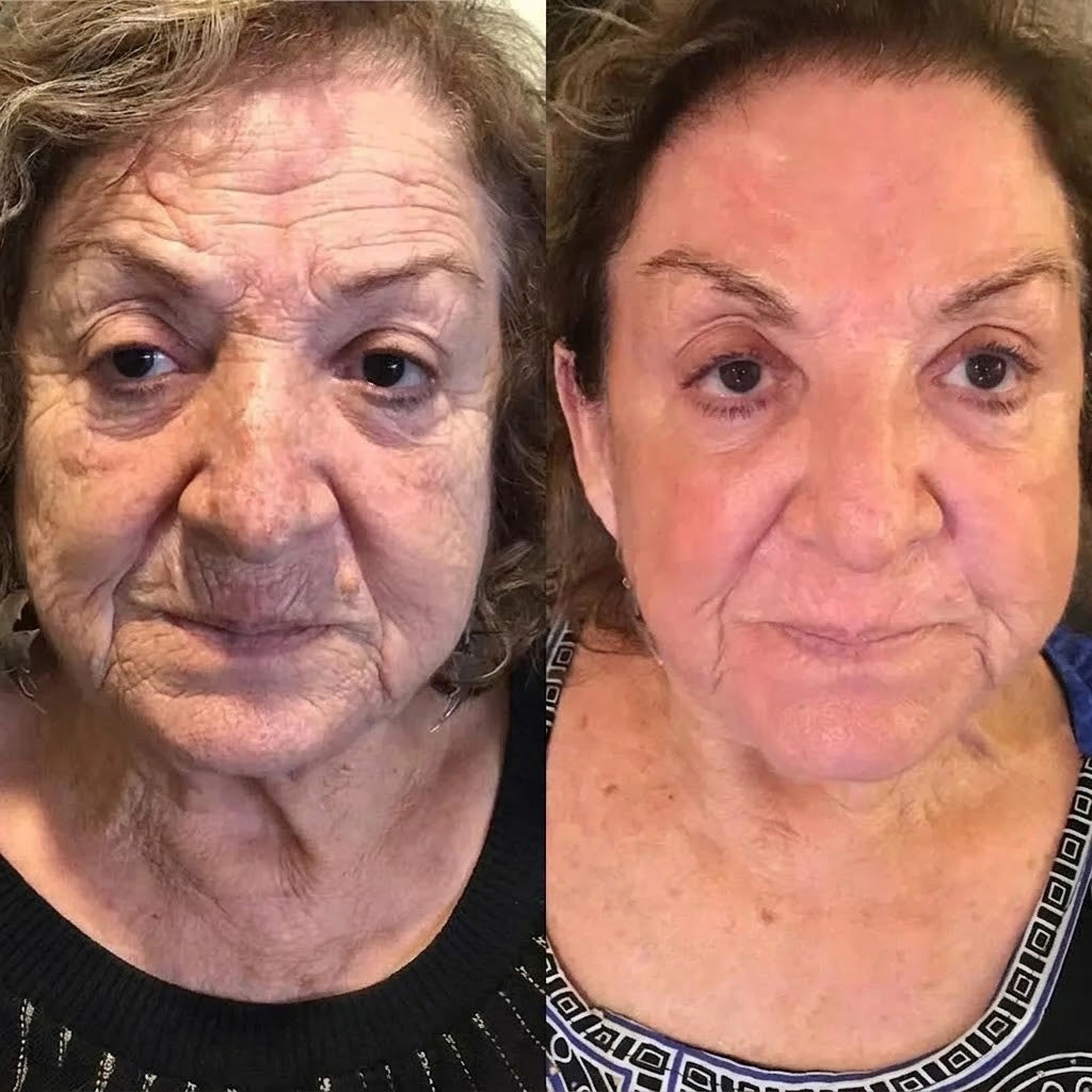 Rolimey®Wrinkle-Lift Tightening cream (upsell)